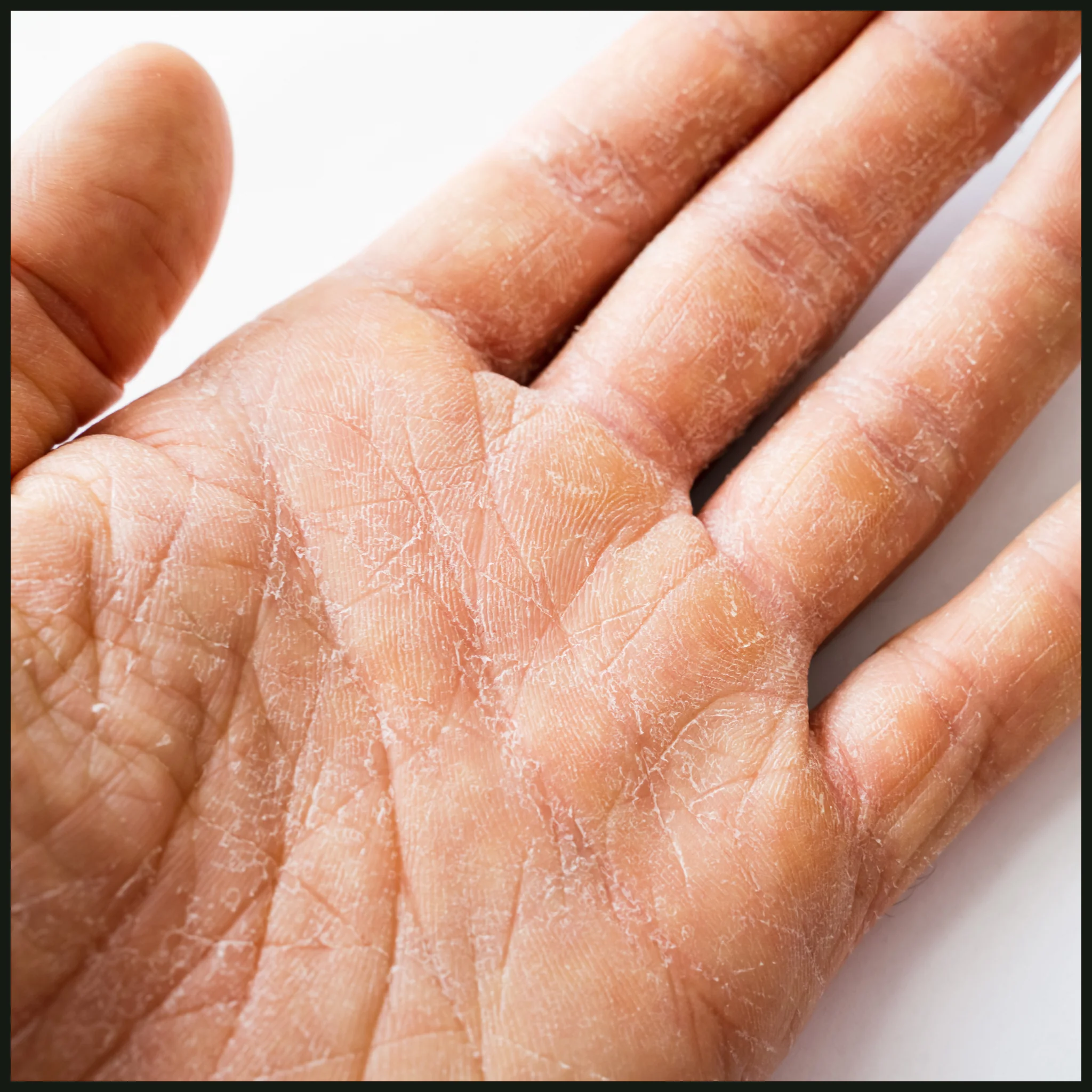 Active Rescue Body Oil 200ml | for Healing | NES142 - Image 3