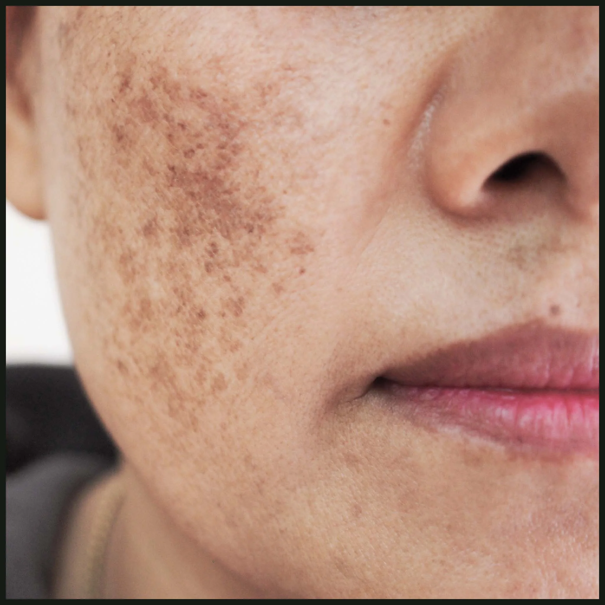 Sample - Pigmentation Skincare Kit 4x5ml | NES602/S - Image 2